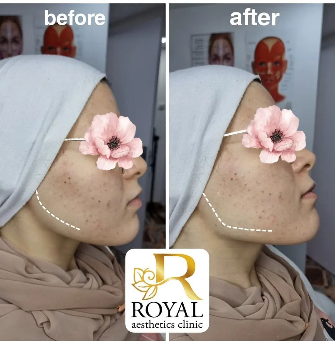 Gallery Royal Aesthetics Clinic Tbilisi